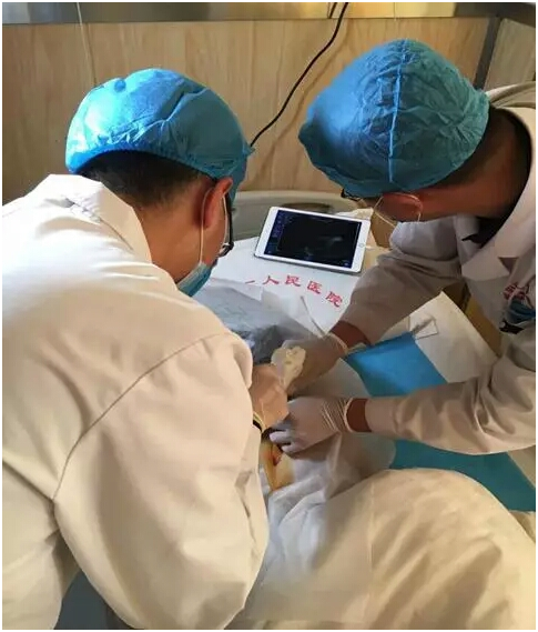 咸阳市第一人民医院成功开展无线探头式超声实时引导下心包积液穿刺闭式引流术