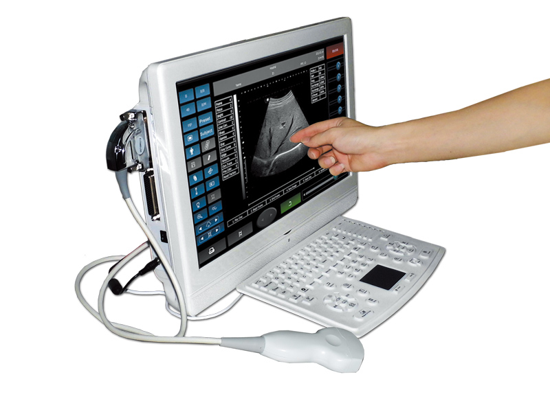 UTouch-8 全数字触摸屏超声诊断仪