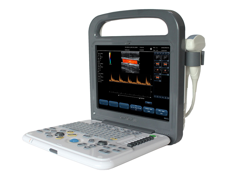 C8便携式彩色多普勒超声诊断系统