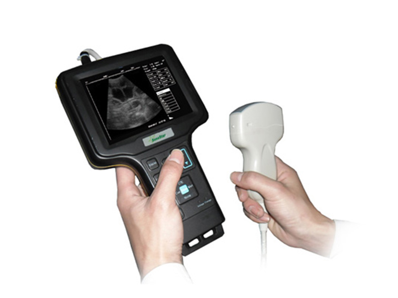V6型掌上式超声显像诊断仪(B超超声诊断仪黑白