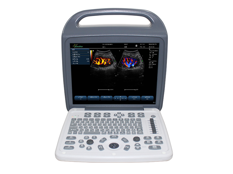 C10M 便携式彩超B超彩超超声诊断仪多普勒