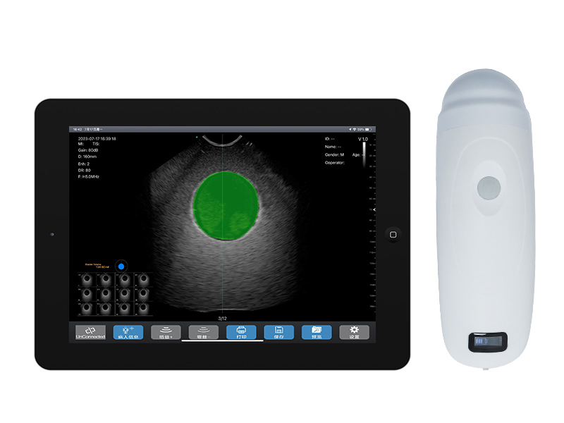 BProbe-5四维扫描无线探头式膀胱