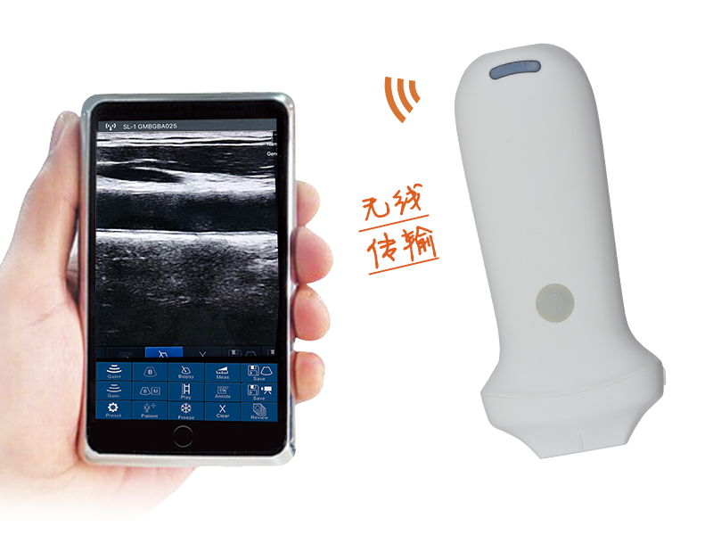 8N超高频线阵无线探头式掌上彩超