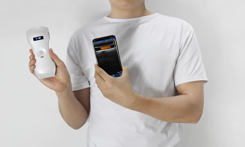 Is Wireless Probe Handheld Ultrasound Hard to Learn & Operate