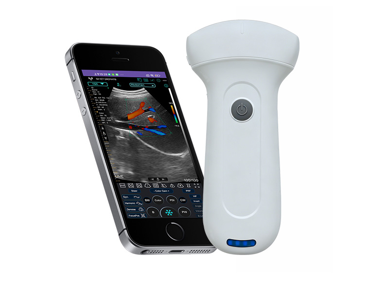 Clinical Procurement Guide for Sonostar Portable Ultrasound Diagnostic Devices