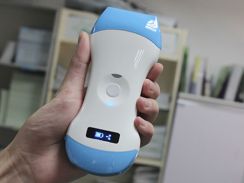 无线掌上彩超设备采购:医疗机构选型实用指南