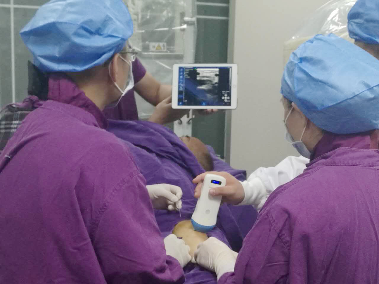 掌上超声进急诊：床旁即时超声（POCUS）能帮医生做什么